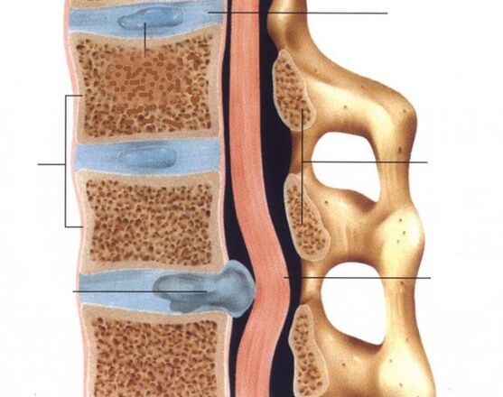 Hernien werden ausgesprochen