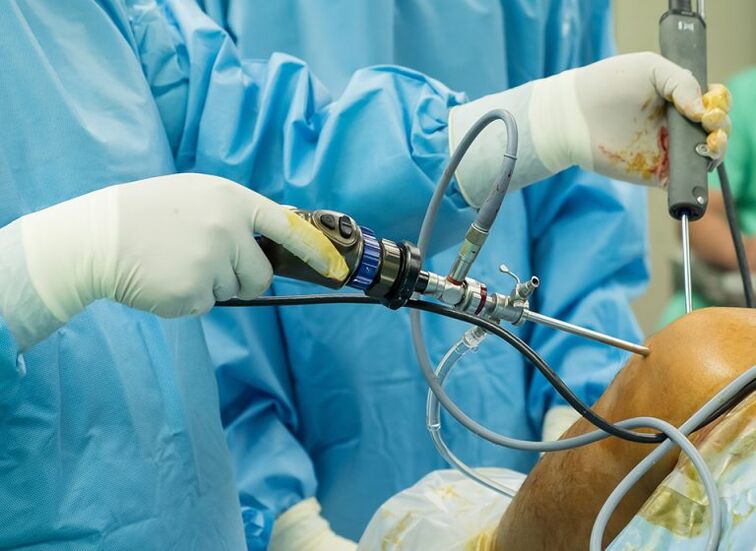Arthroskopie - Operation bei Arthrose des Kniegelenks