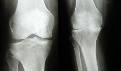 Kniediagnosemethoden