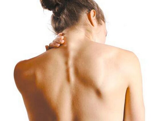 Das Mädchen leidet an zervikaler Osteochondrose.