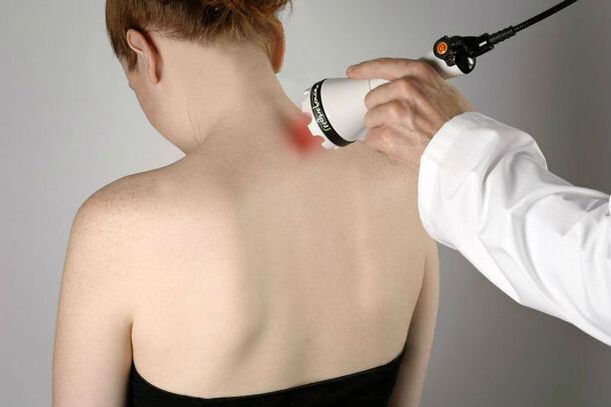 physiotherapeutische Maßnahmen zur Behandlung der zervikalen Osteochondrose