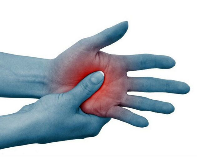 Starke Schmerzen in den Fingergelenken, die bei körperlicher Betätigung nachlassen, sind ein typisches Anzeichen einer rheumatoiden Arthritis.